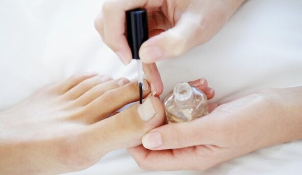 Applying a healing varnish is a mandatory daily procedure in the treatment of fungus. 